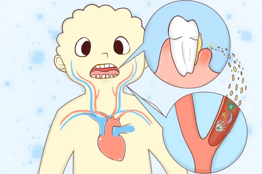 口腔健康与心、脑血管疾病